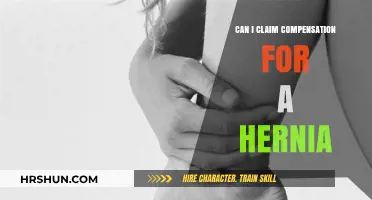 Understanding Hernia Compensation Claims: A Comprehensive Guide