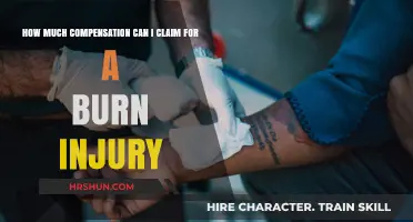 Understanding Burn Injury Compensation: A Comprehensive Guide