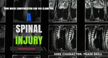 Understanding Spinal Injury Compensation: A Comprehensive Guide